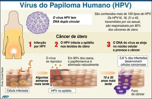 Nhiễm HPV - nguyên nhân của nhiều loại u & ung thư